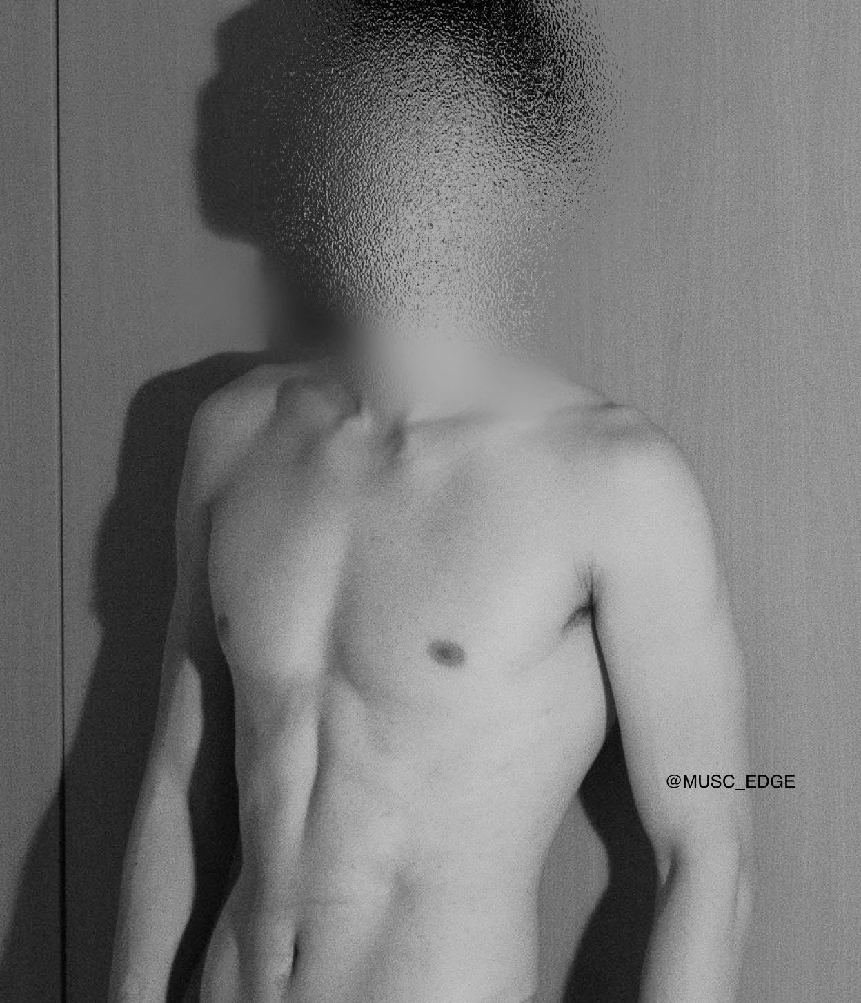 MUSC_EDGE
